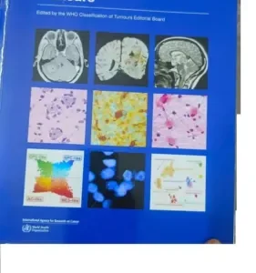 Central Nervous System Tumours Paperback
